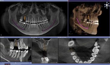 pic zahnarzt dr bergmann roentgen